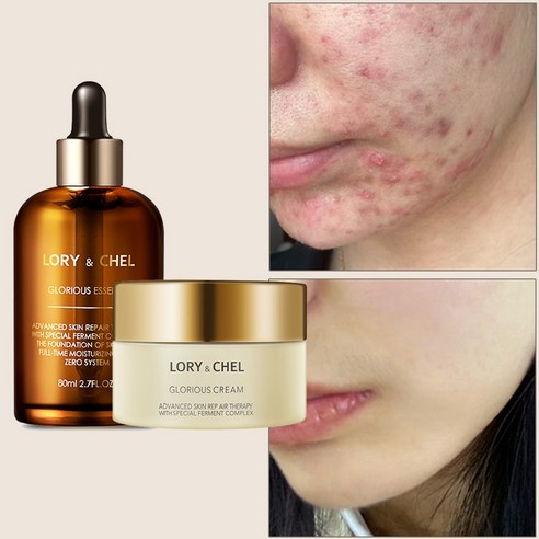 LORY & CHEL Glorious Moisture Cream & Essence Set