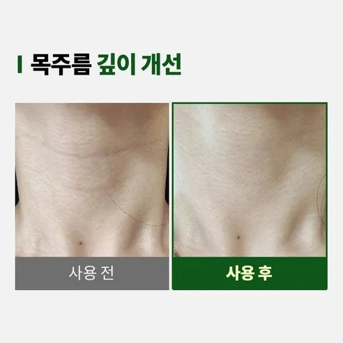 VISOLE Dongan Anti-Wrinkle Lifting Cream for Nasolabial Folds, Eye Area and Neck, 75ml - Image 2