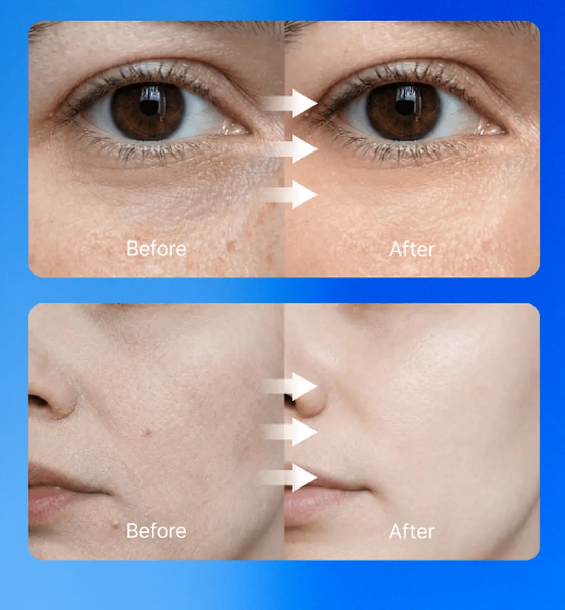 ASCEplus ExoBalm SR2 W-Formula 20ml - Night Intensive Care for Skin Constitution Improvement