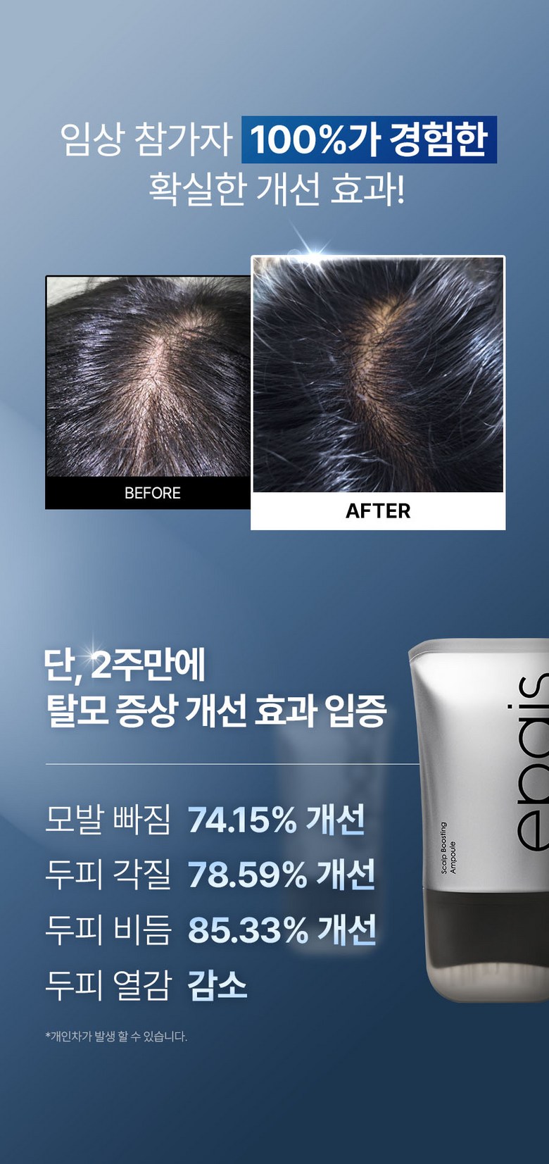 AEPE Scalp Boosting Scalp Hair Loss Ampoule 150ml, 1pc - Hair Essence / Oil Detail