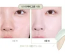01 Recover Green