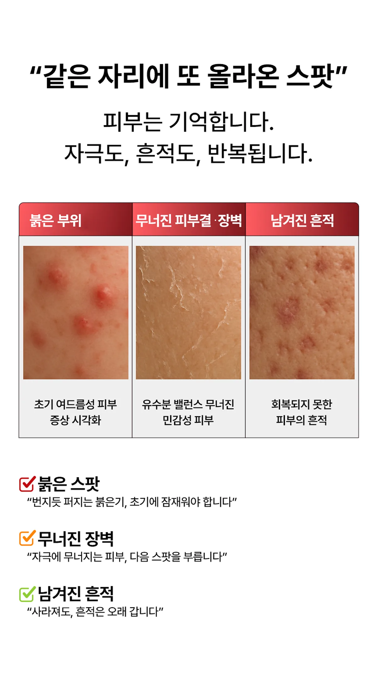 17Hours Red Spot Cream Detail