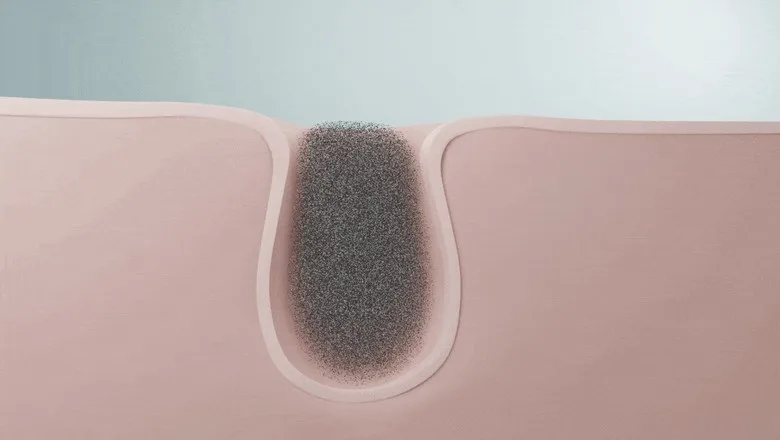 23yearsold ZERO BLACKHEAD BAR 50g 2pcs Detail