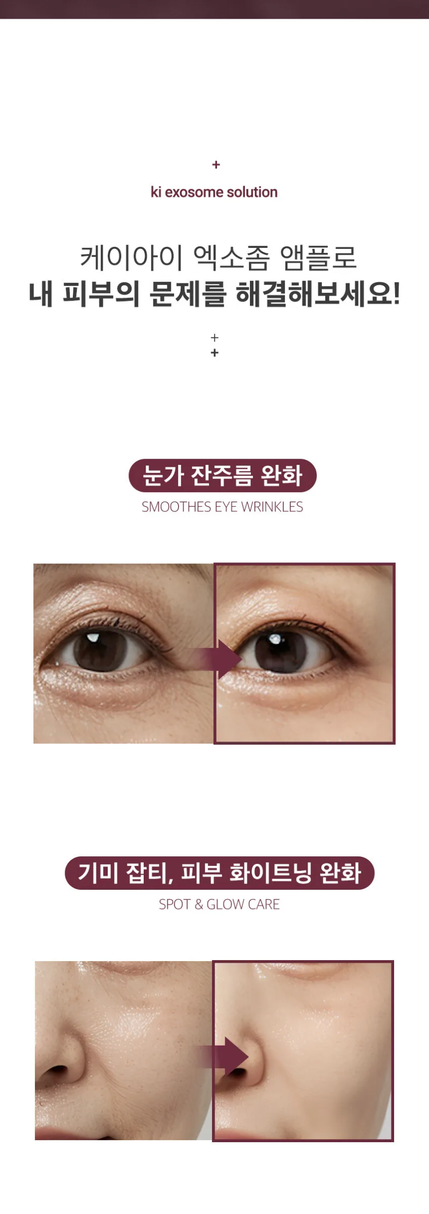 ki cosmetics Stem Cell Exosome Skin Booster Kit (Ampoule 30ml+Stem Cell 0.35ml*5ea) Detail