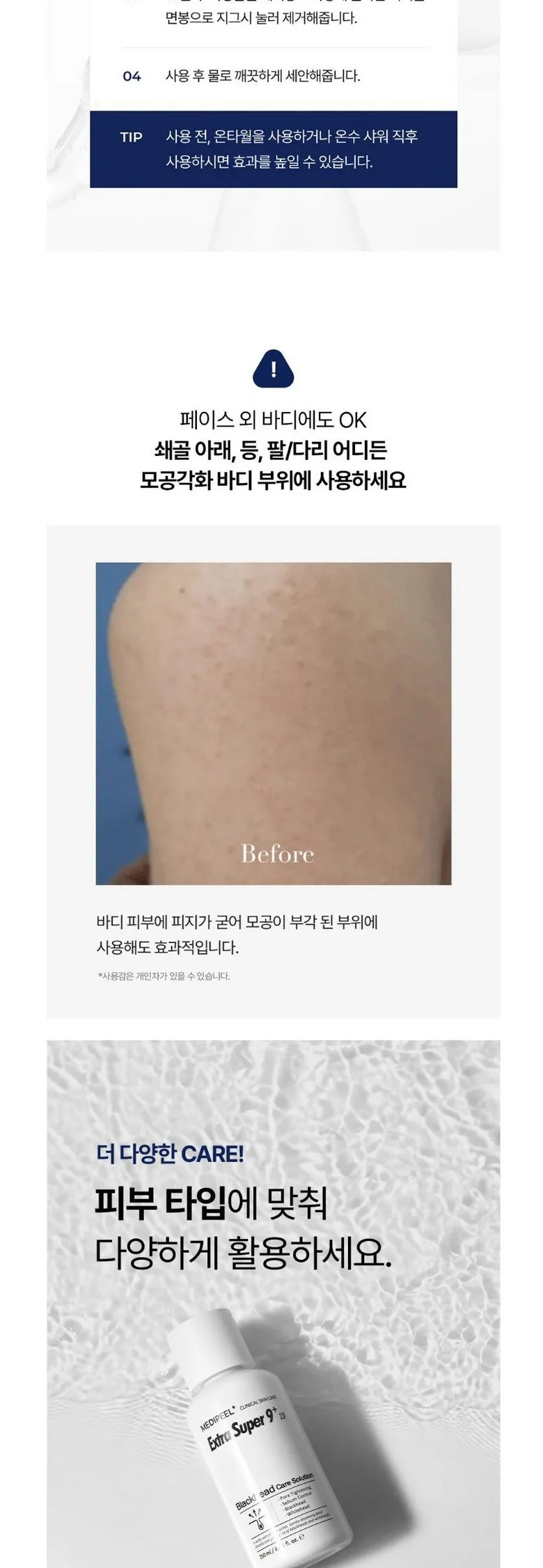 MEDIPEEL Extra Super 9 Plus 2.0 Blackhead Care Solution 250ml Detail