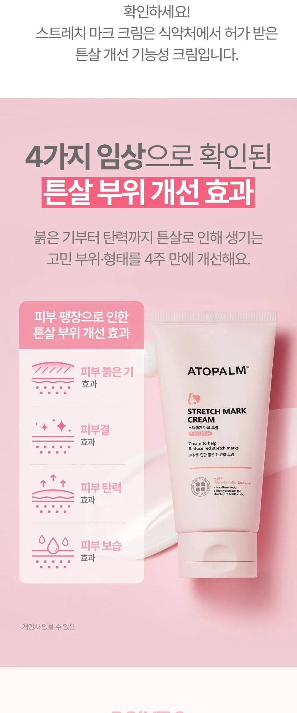 ATOPALM Stretch Mark Cream 150ml Detail