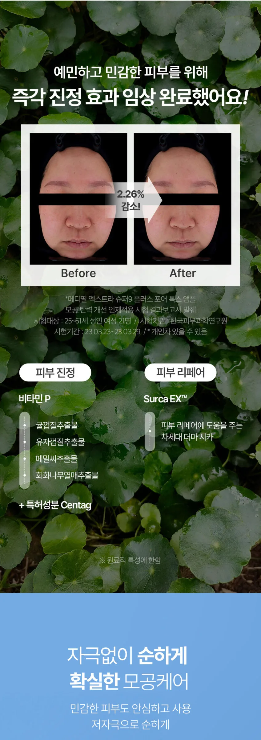 MEDIPEEL Extra Super 9+ Blackhead and Pore Care Set (Solution 250ml+Ampoule 30ml) Detail