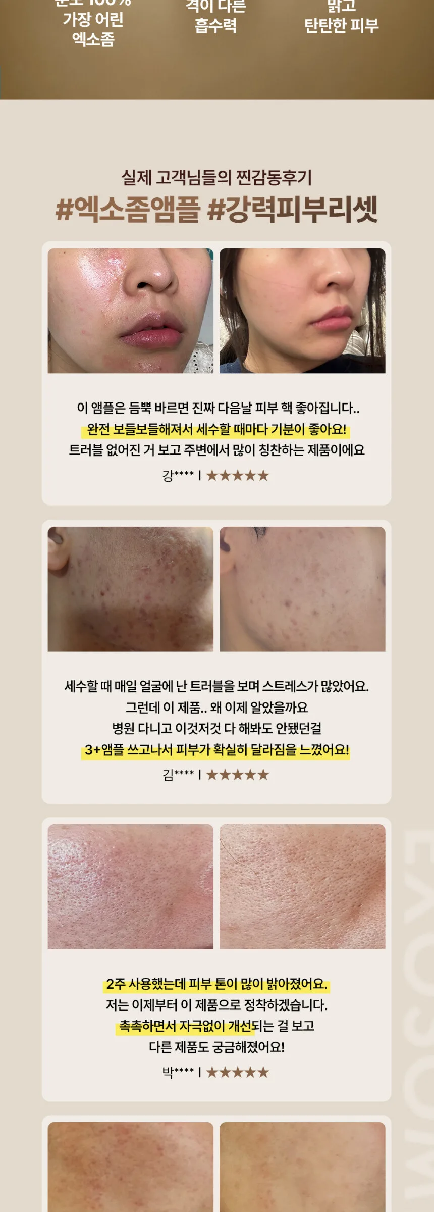 GD11 Premium RX Cell Treatment Program (2ml+5ml)*3ea Detail