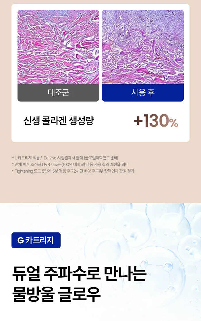 SHURINK HOME Lift2Glow HIFU Beauty Device + Gel Cream Detail