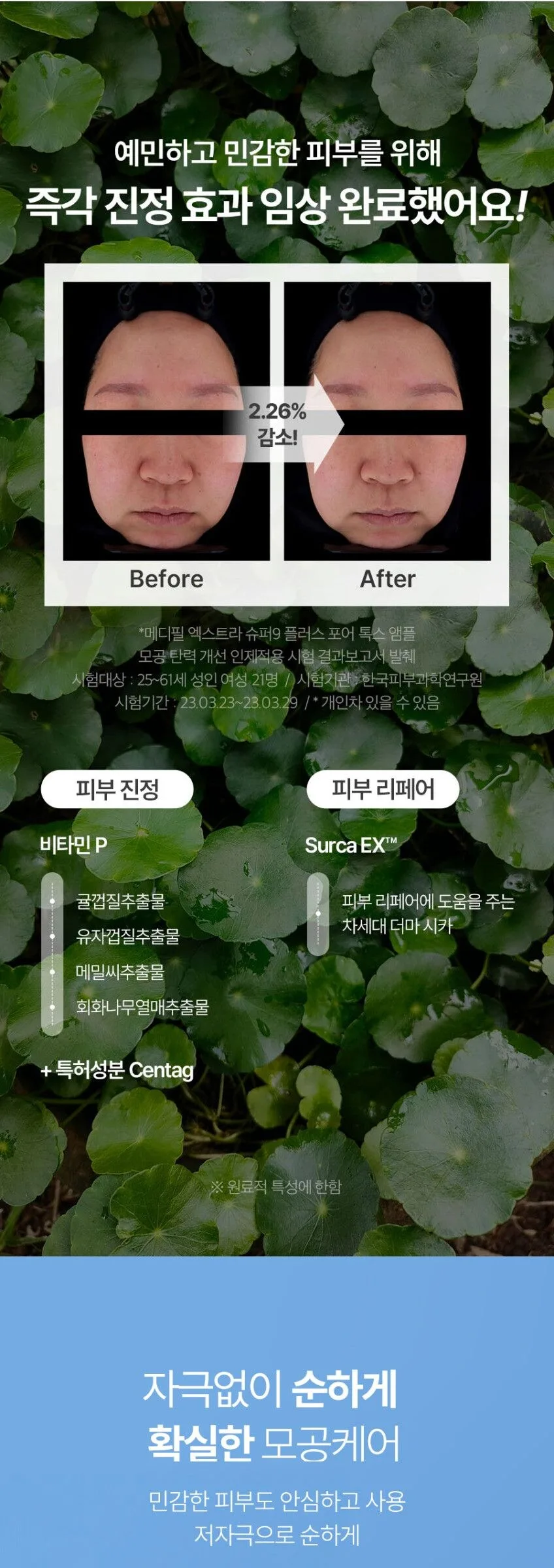 MEDIPEEL Extra Super 9+ Blackhead and Pore Care Set (Solution 250ml+Ampoule 30ml) Detail