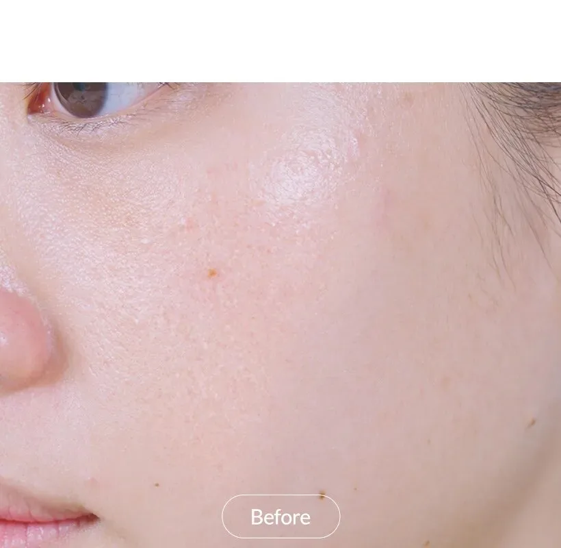 MIZON Cicaluronic Toner 150ml Detail