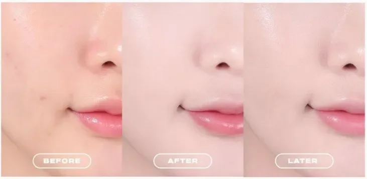 ABOUT TON Skin Layer Cover Fit Concealer 5.6g - Image 2