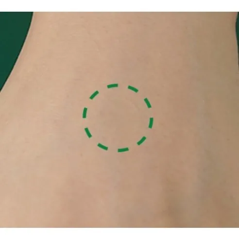 CURESYS Heartleaf Acpair Spot Patch 90 Dots*2packs - Image 4