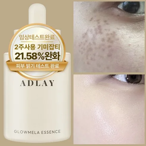 ELIMERE ADLAY Whitening Pigmentation Melasma Brightening Essence Ampoule 50ml