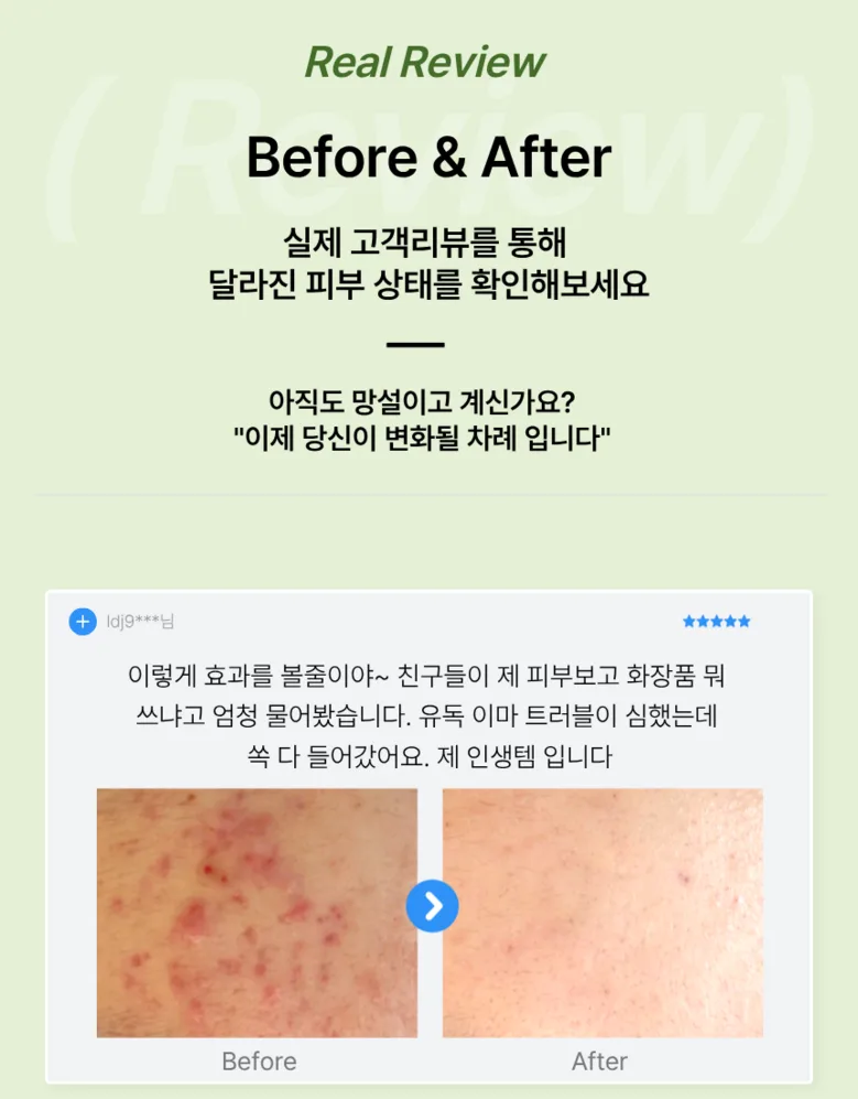 LumiPure Inseleo Phytoacin Cream 100ml - Centella Cica Cream with Panthenol, Hyaluronic Acid, Ceramide Detail