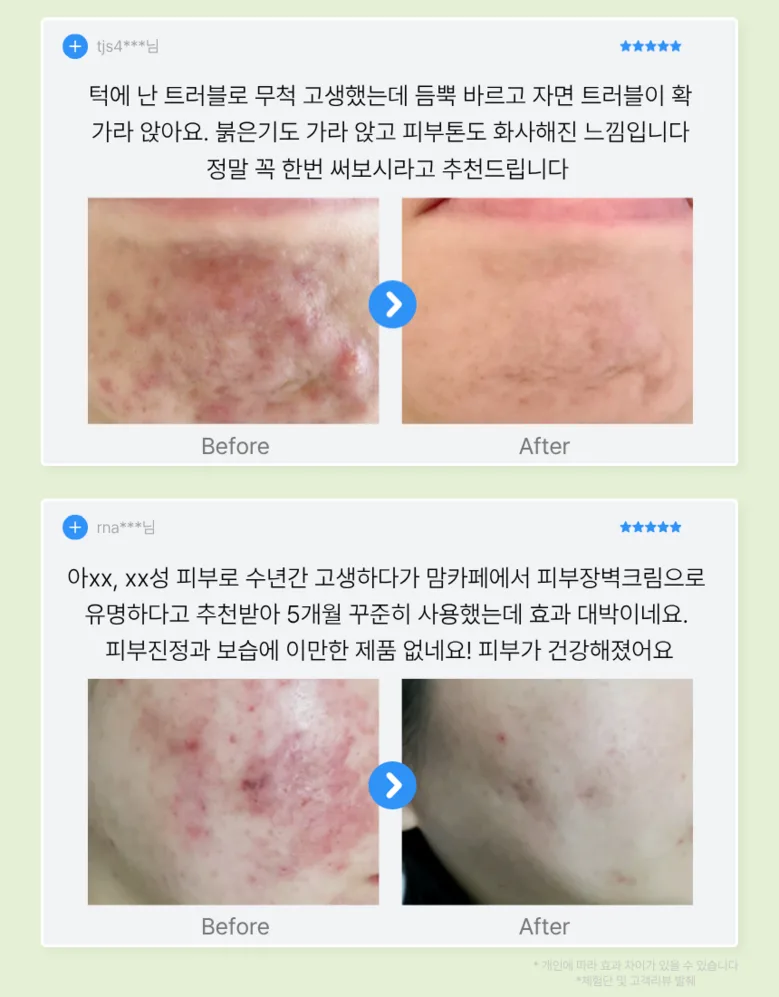 LumiPure Inseleo Phytoacin Cream 100ml - Centella Cica Cream with Panthenol, Hyaluronic Acid, Ceramide Detail