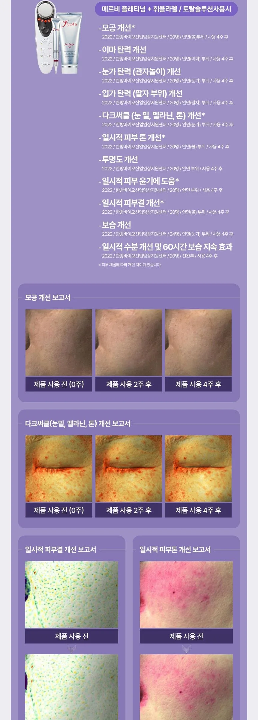 Merbe Platinum Beauty Devices Galvanic Ion + Ultrasonic + Infrared Function Detail