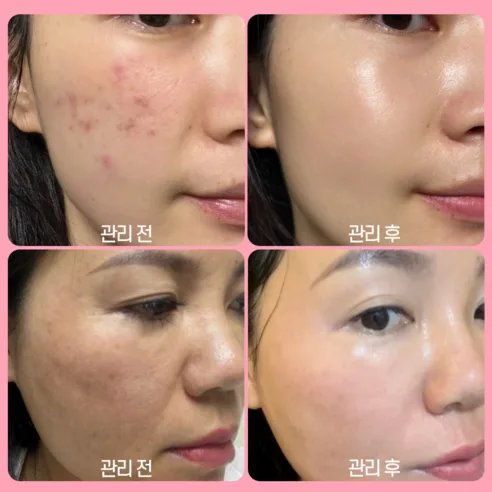 Rx:Derma EGF Cica Regen Cream 50ml - Image 5