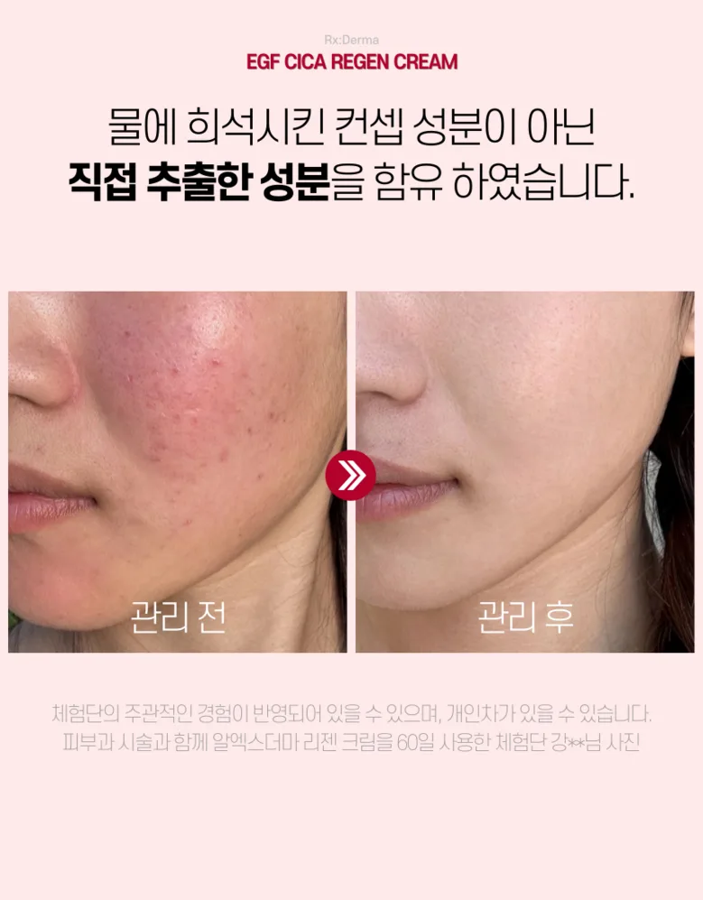 RXDerma EGF Cica Cream Ceramide Panthenol Centella 50ml - Skin Barrier Repair Detail