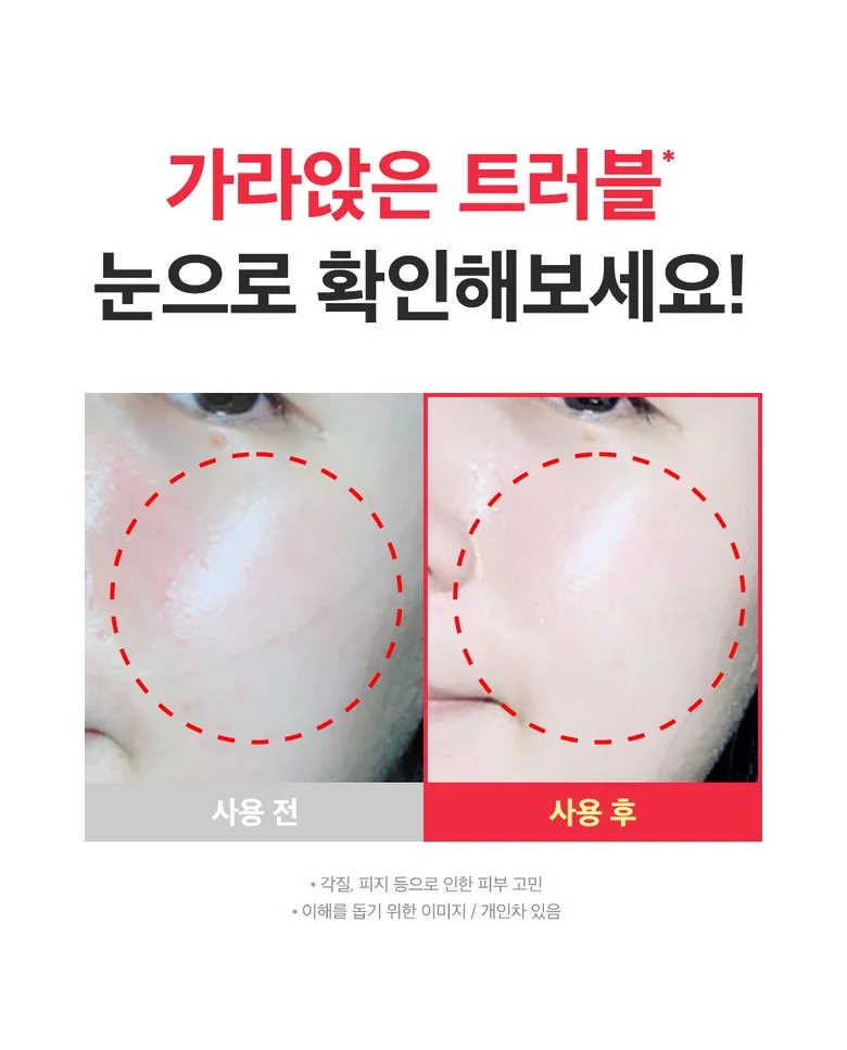 Seongbun Editor Red Eoseongcho Soothing Ampoule 40ml - Acne Calm & Moisturizing Detail