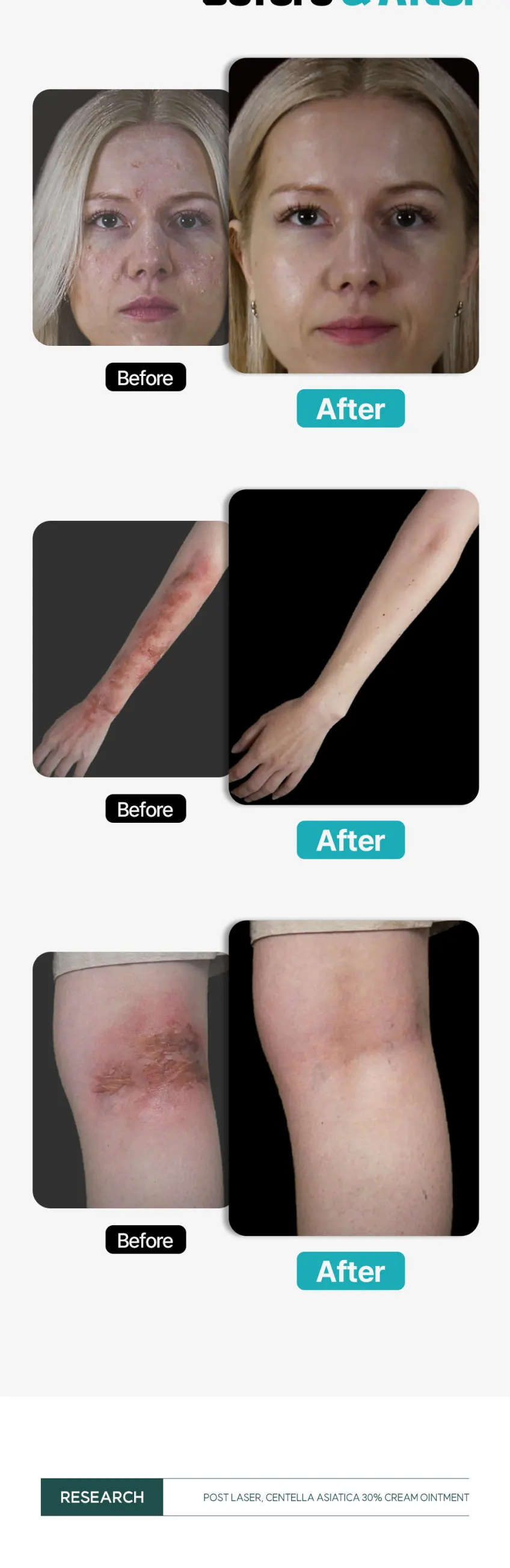 Dr. STERN Post Laser Centella Asiatica 30% Cream Ointment 50g Detail
