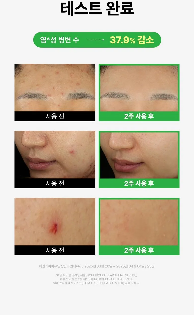EiOM Trouble Patch Mask 20ml 4 Sheets Detail