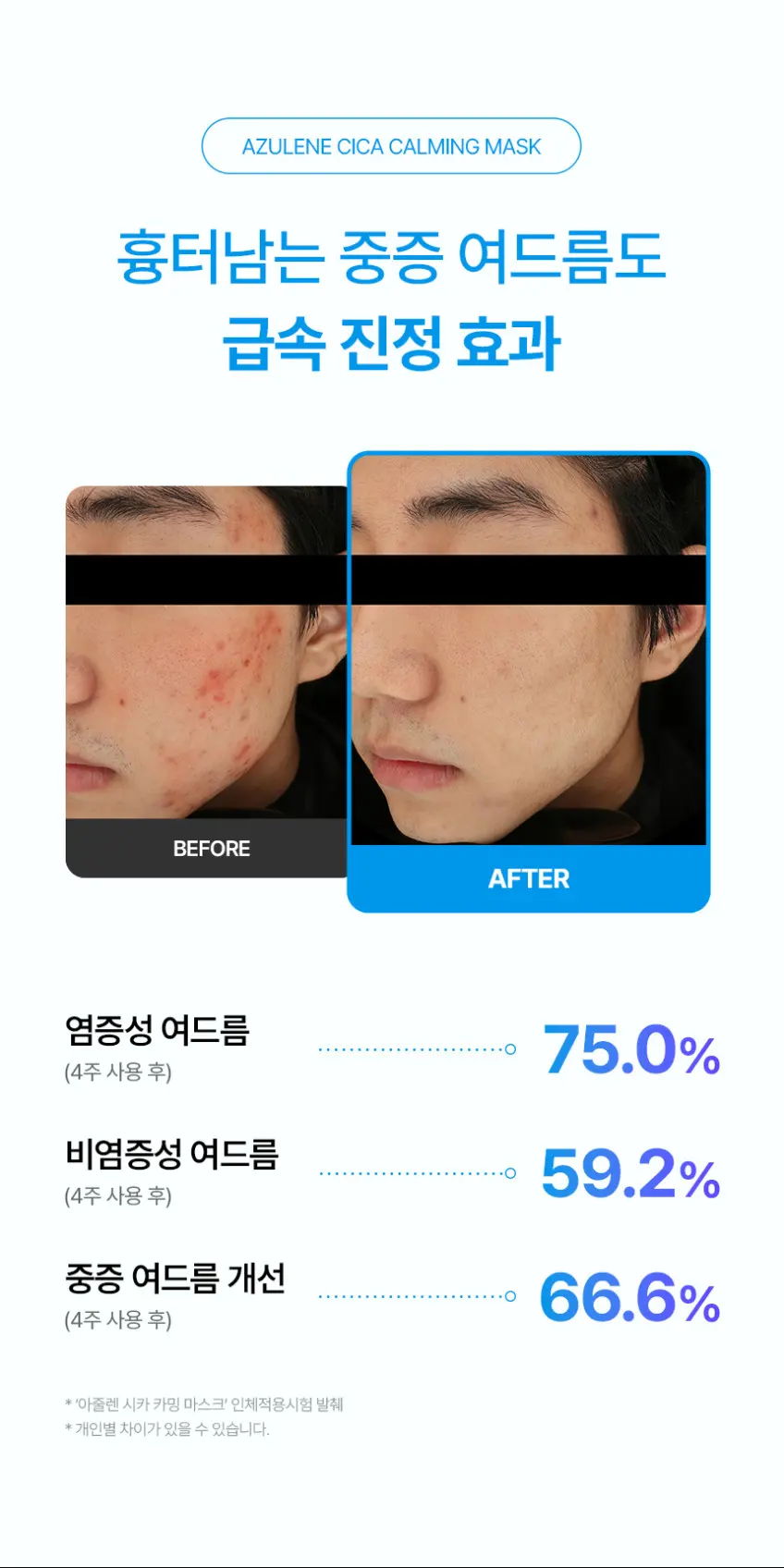 from medi+ AZULENE CICA CALMING MASK 30g x 4 (Azulene Cica Soothing Gel Mask) Detail