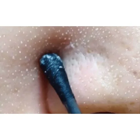 ilso Natural Mild Clear Nose Pack - Image 7