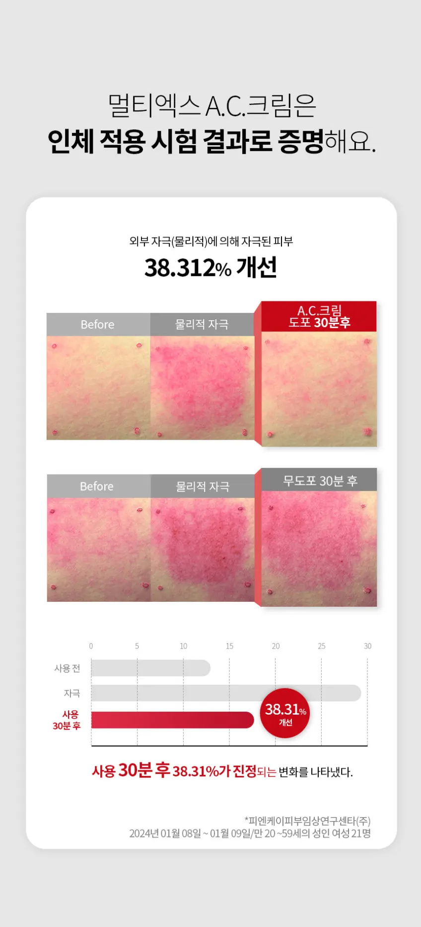 LAB FOR YOU Multi-Ex A.C. Cream 20ml Detail