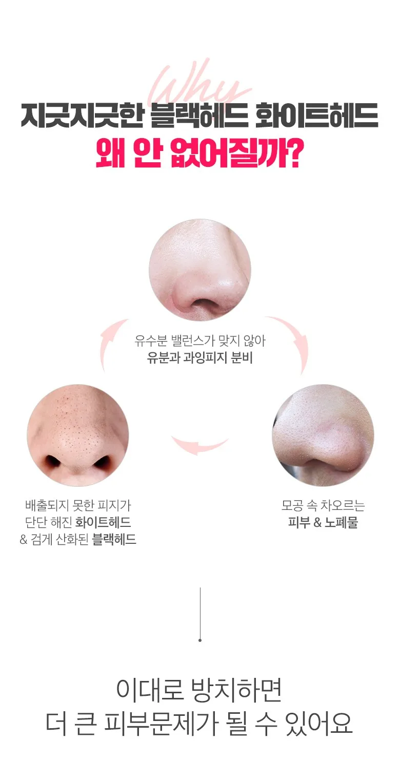 me factory 3 Step Piggy Nose Strip, 10 Pieces, 1 Pack Detail