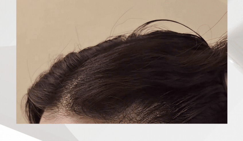MODA MODA SCALP-LAB RX Gwalsa Ampoule 100ml Detail