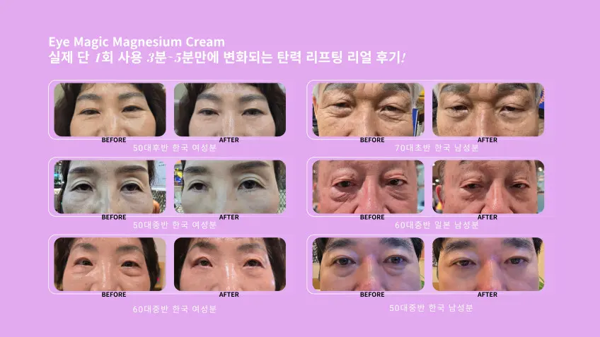 WhiteBling Eye Magic Magnesium Cream 15g Detail