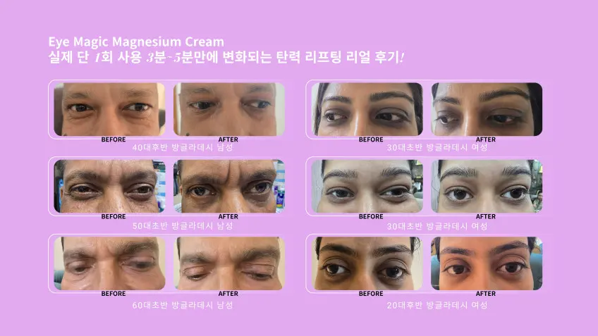 WhiteBling Eye Magic Magnesium Cream 15g Detail