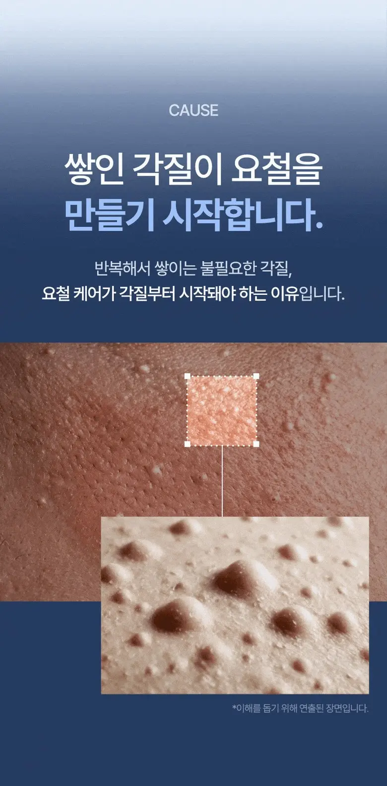 CellFlora Cream 30ml Spot Cream (CellFlora) Detail