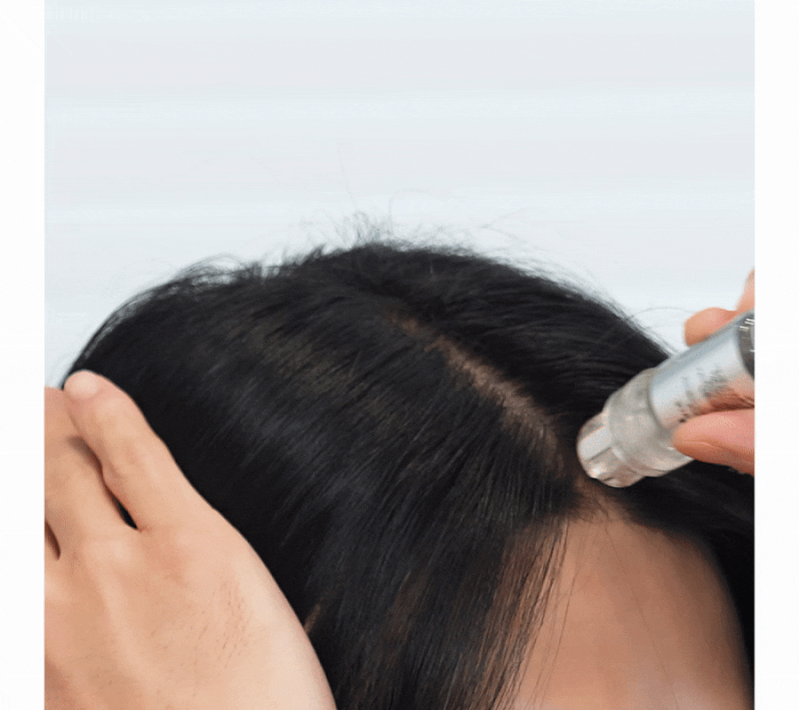 FORBEAUT Micro Boost Scalp Ampoule MTS 500 Red Boost Detail