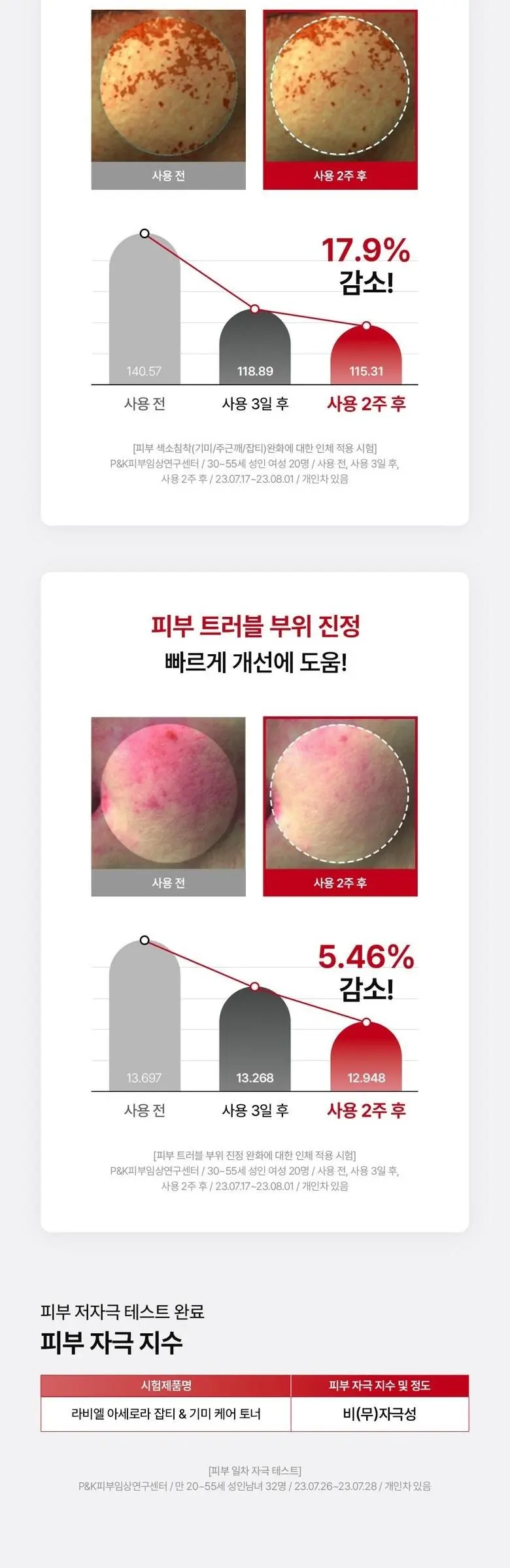 RAVIEL Acerola Dark Spot & Blemish Care Toner 150ml, 1 Bottle Detail