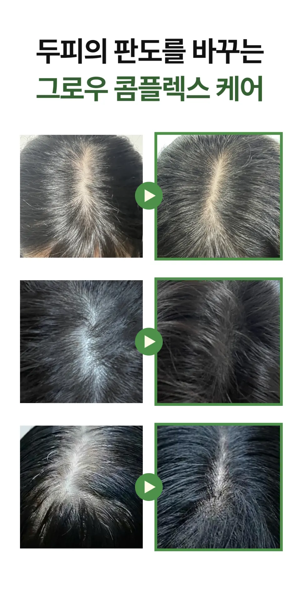 ROOTONIX Rosemary Biotin Scalp Tonic 100ml Detail