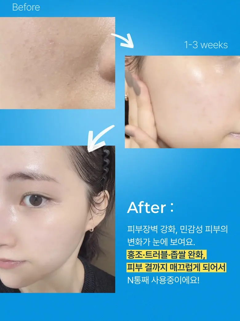 ZIGTAG Cerachiol Crush Cream 50ml - Ceramide Bakuchiol Firming Pore Barrier Moisturizer Detail