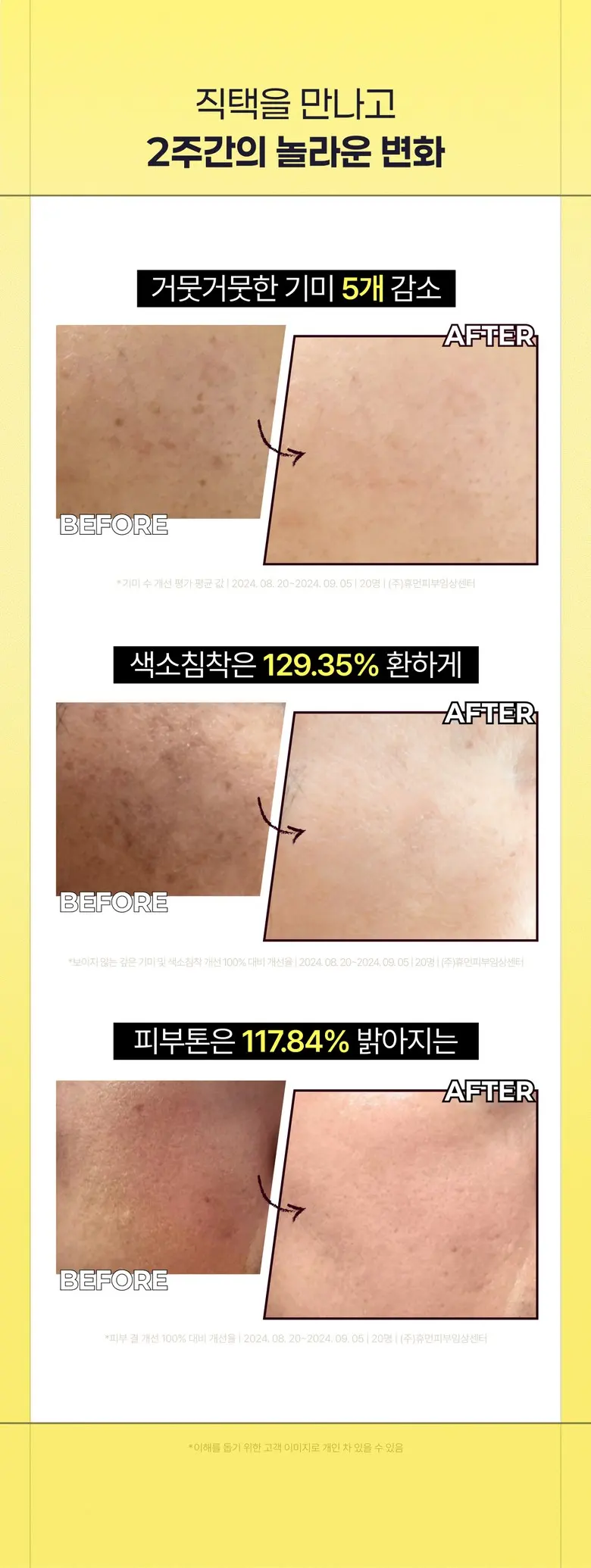 ZIGTAG Vitamin C 15% Super Blast Ampoule 24ml - Pure Ascorbic Acid Serum for Dark Spots & Brightening Detail