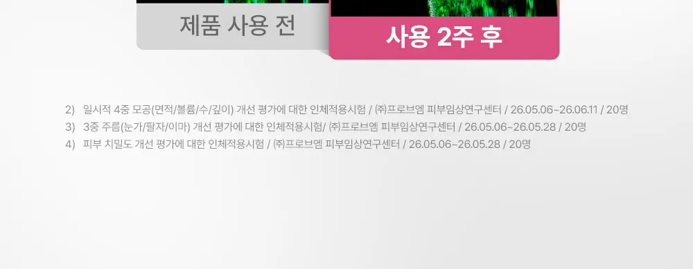 레티날 0.1 피디알엔 5000 크림 20ml Detail