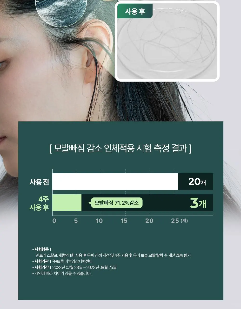 [올영1위 두피앰플] 민트리 스칼프 세럼 20ml | 올리브영 Detail