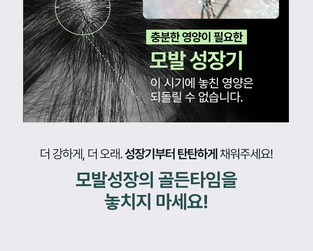 [올영1위 두피앰플] 민트리 스칼프 세럼 20ml | 올리브영 Detail