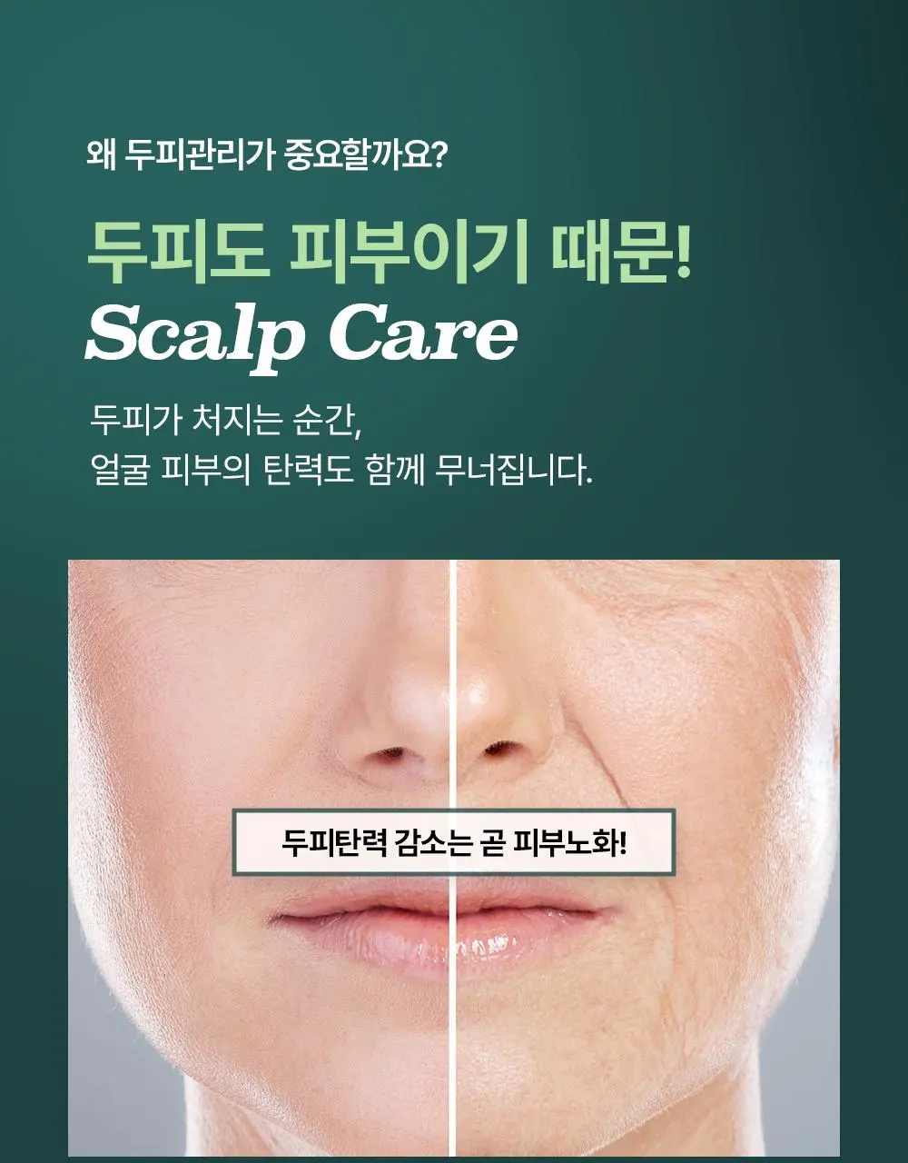 [올영1위 두피앰플] 민트리 스칼프 세럼 20ml | 올리브영 Detail