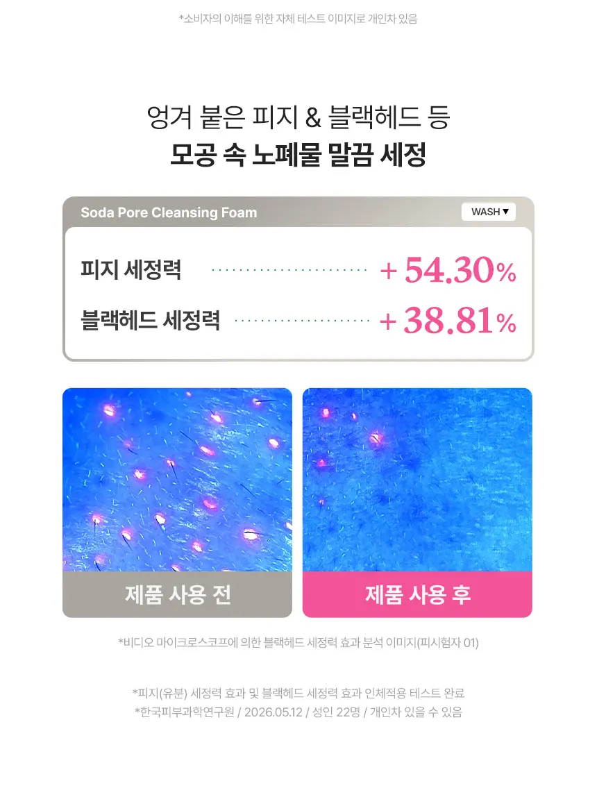소다 포어 클렌징 폼 120ml Detail
