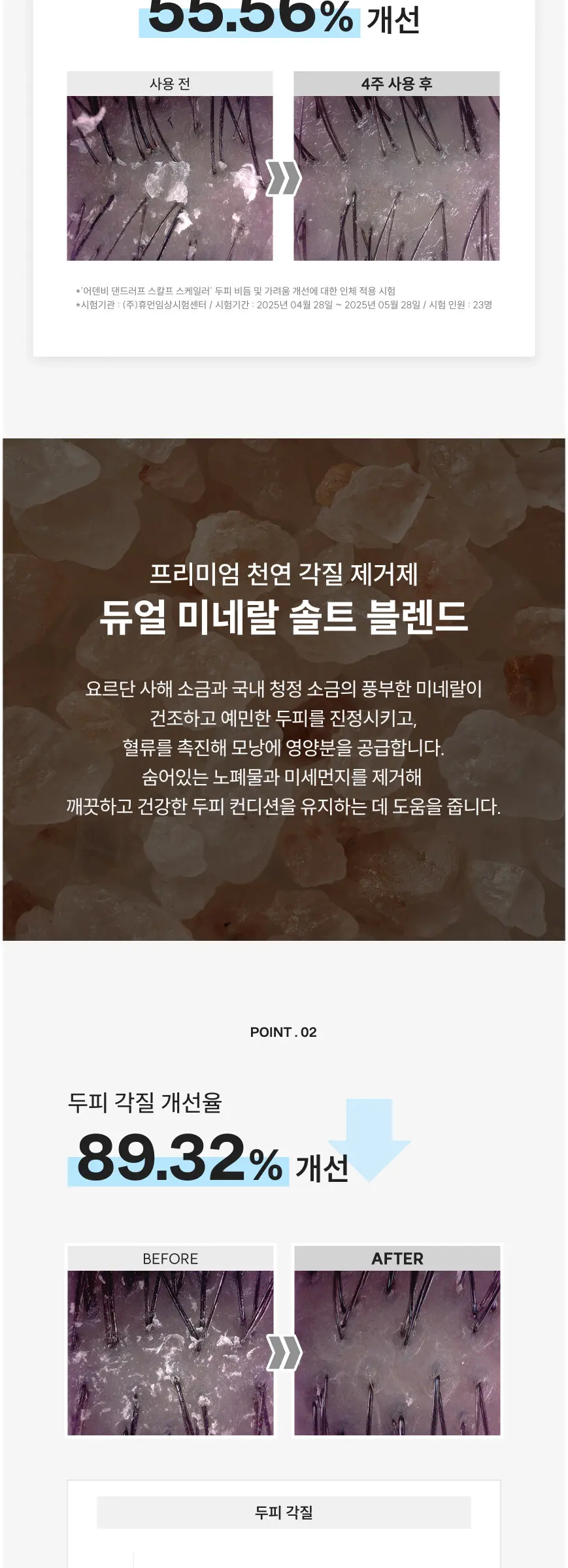 댄드러프 스칼프 스케일러 150g Detail