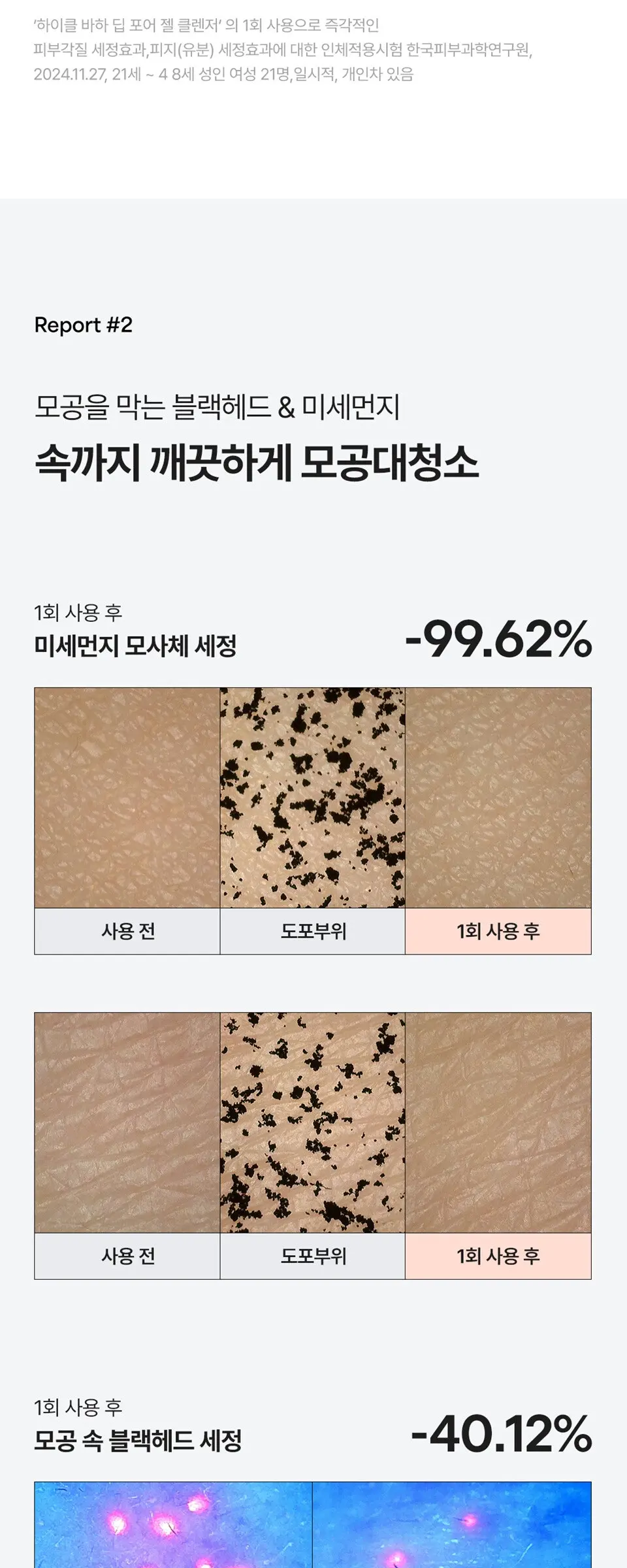 바하 딥 포어 젤 클렌저 150ml Detail