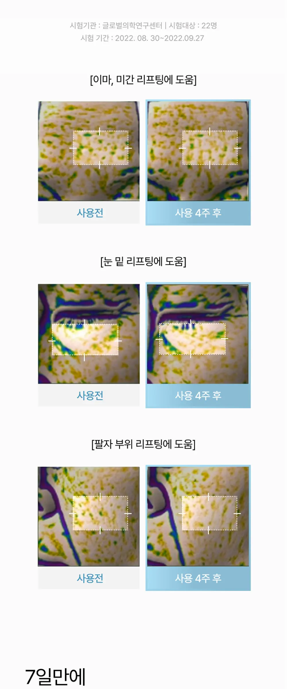 부활초 엑소좀 딥리프팅 콜라겐 마스크 1매 Detail