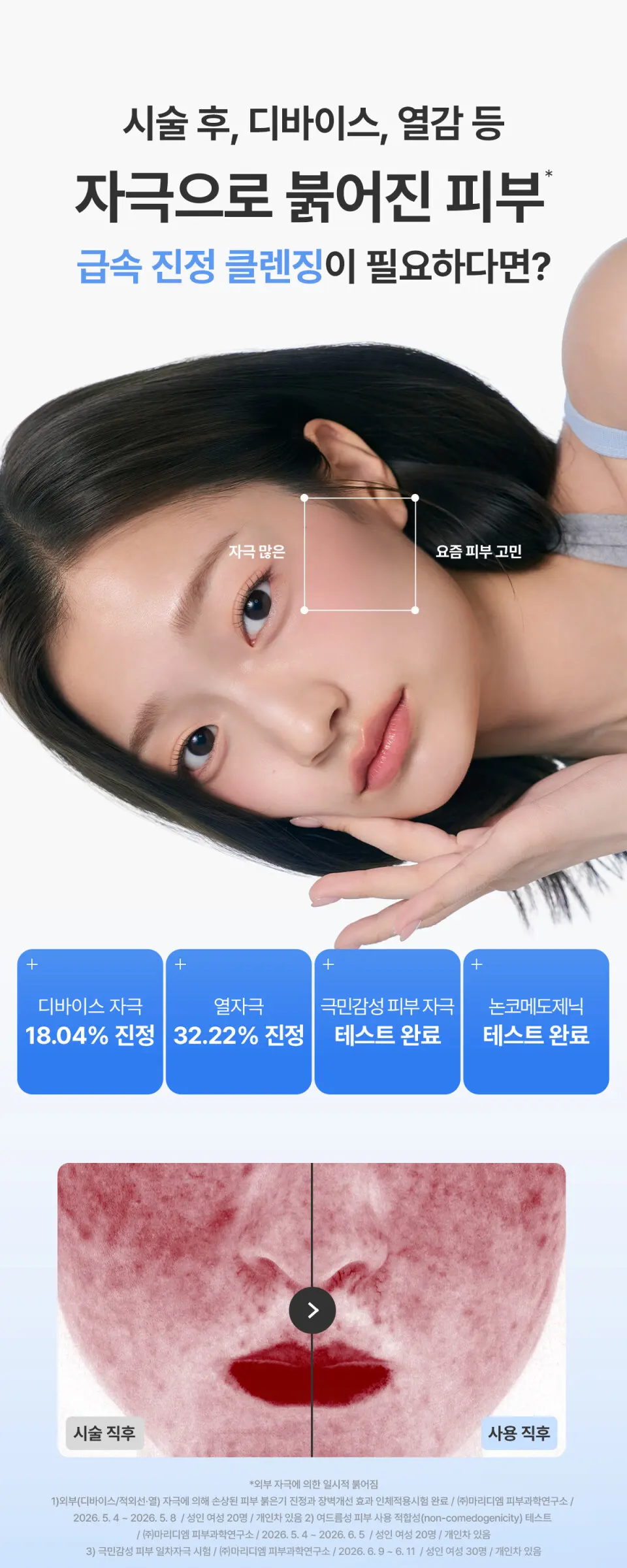 아줄렌 히알루로닉2 엑스 세럼 오일 클렌저 200ml Detail