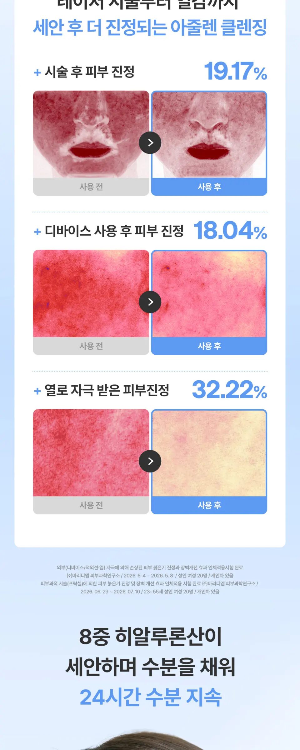 아줄렌 히알루로닉2 엑스 세럼 오일 클렌저 200ml Detail