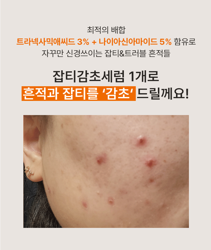 타겟티드 블레미쉬 세럼 트라넥사믹애씨드 3.0 30ml Detail
